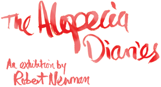The Alopecia Diaries